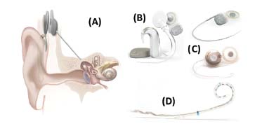 Pushing the Envelope of Auditory Research with Cochlear Implants – Matthew J. Goupell