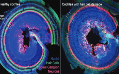 Regeneration of Auditory Hair Cells: A Potential Treatment for Hearing Loss on the Horizon – Rebeca M. Lewis