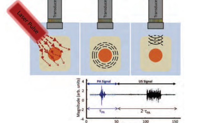 PHOTOACOUSTIC IMAGING FOR MEDICAL DIAGNOSTICS